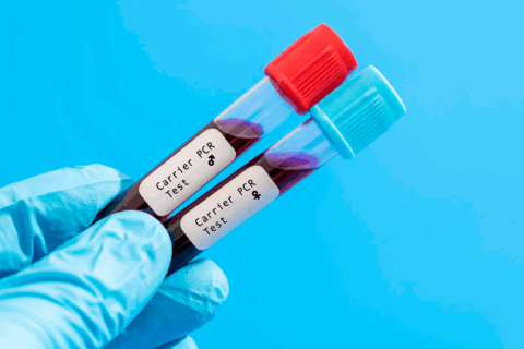 Genetic Carrier Screening